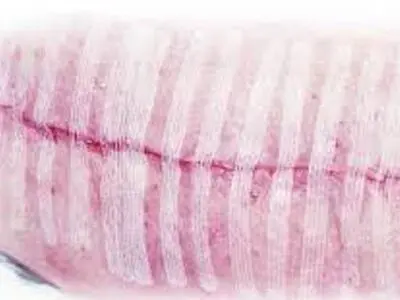 چسبی که جایگزین بخیه می شود+عکس 
