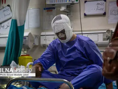 آمار مصدومان حوادث چهارشنبه سوری در گیلان از ۹۰ نفر عبورکرد