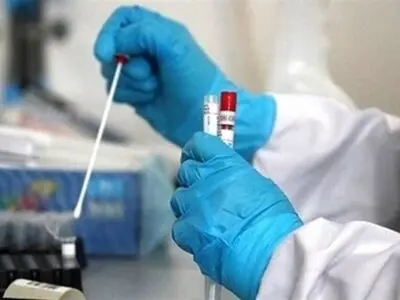 فهرست آزمایشگاه‌های تشخیص کووید ۱۹ اعلام شد

