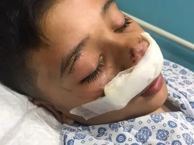 پسر نوجوان کرجی در اثر گاز گرفتگی سگ روانه بیمارستان شد