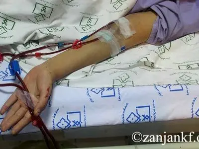 6 مرکز انجمن حمایت از بیماران کلیوی در زنجان فعال است 