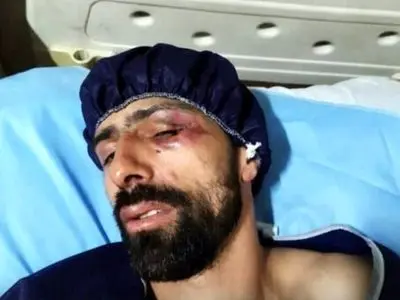 حمله مسلحانه علیه ملی‌پوش المپیکی سابق اسکی