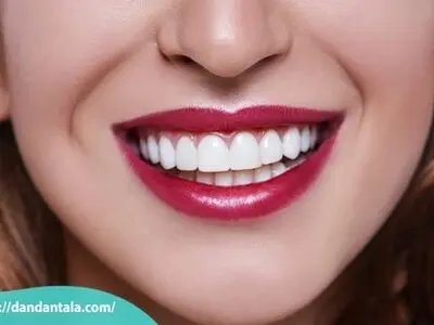 اصلاح طرح لبخند با لمینت یا کامپوزیت کدام یک بهتر است؟