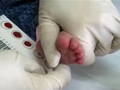 اعلام فهرست مراکز غربالگری بیماری‌های دوران نوزادی در تهران