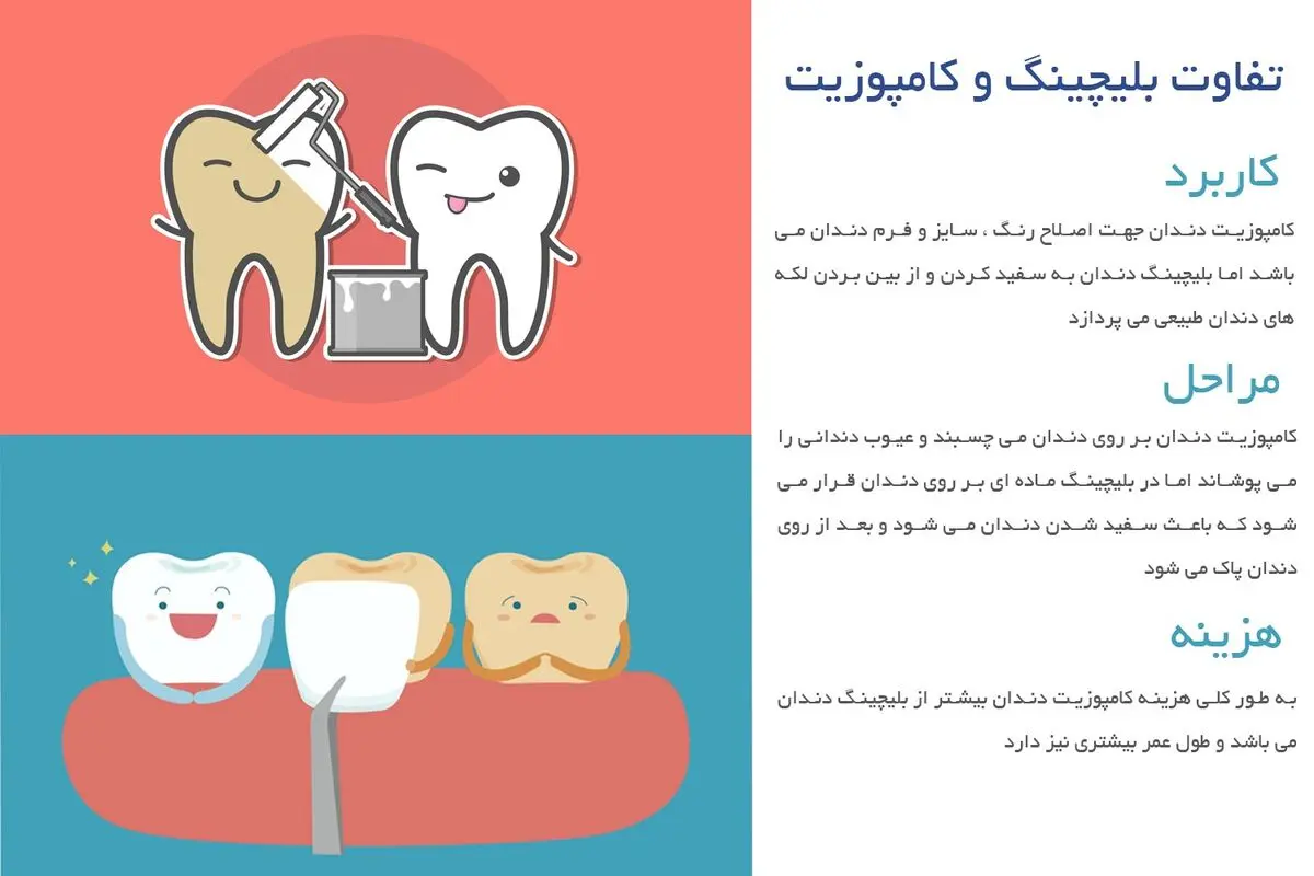 تفاوت بلیچینگ و کامپوزیت در چیست ؟