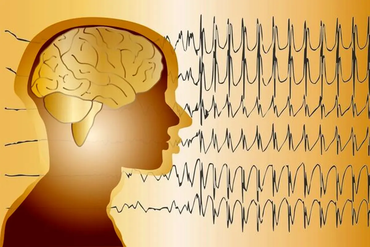 توصیه به مبتلایان صرع در پاندمی کرونا