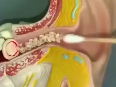 مقایسه گوش پاک کن فنری با گوش پاک معمولی + فیلم