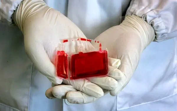 نخستین بانک ذخیره خون بندناف با توان داخلی تولید شد / جمع آوری بیش از ۱۶ هزار نمونه خون بندناف در فارس
