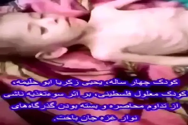 کودک معلول فلسطینی، بر اثر سوءتغذیه ناشی از تداوم محاصره جان باخت + فیلم