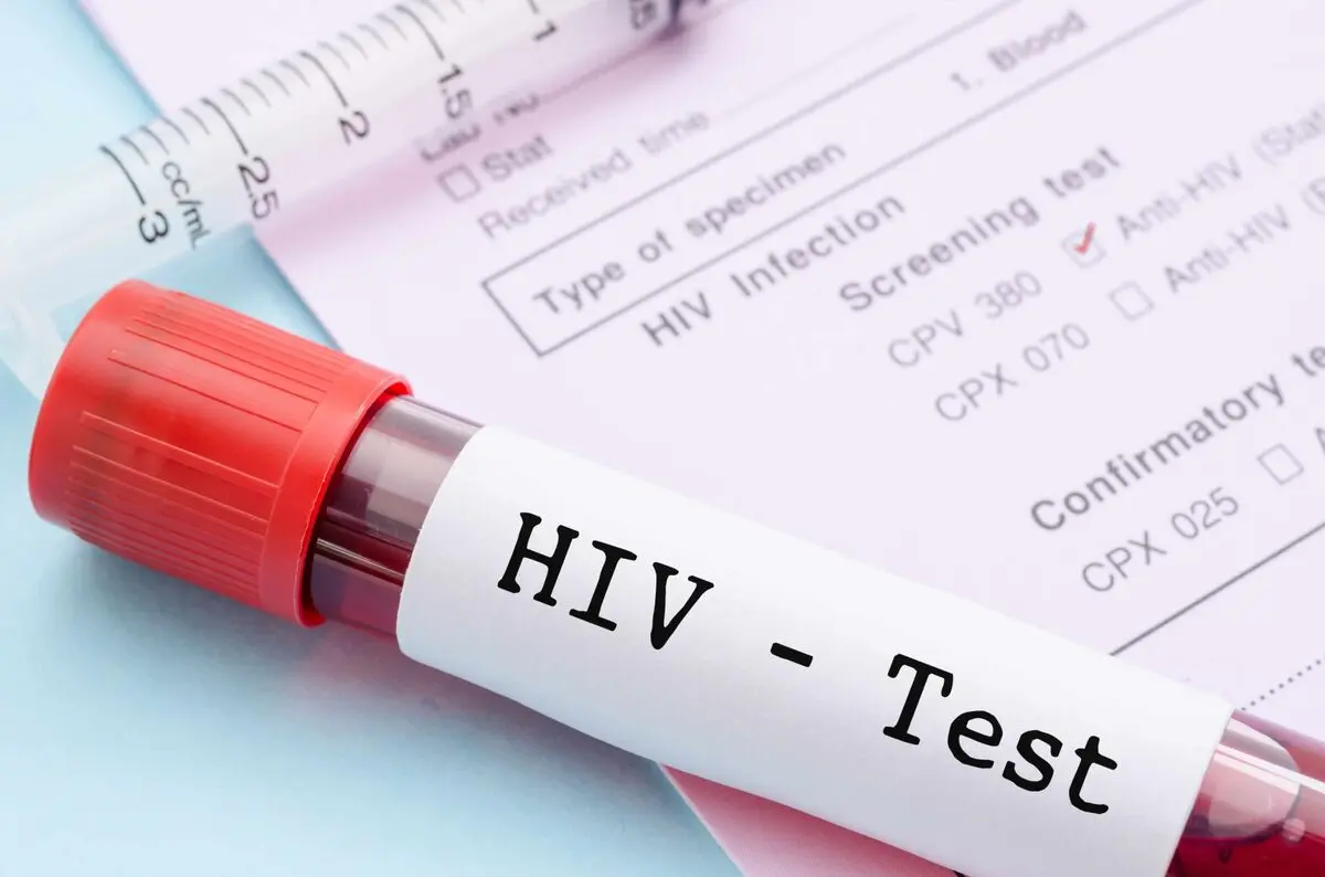 تغییر الگوی انتقال HIV به سمت رفتارهای مخاطره‌آمیز جنسی 