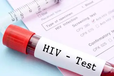 استفاده از داروی ضدسرطان برای حذف دائمی ویروس HIV