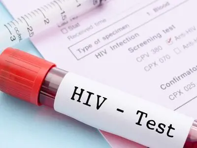 استفاده از داروی ضدسرطان برای حذف دائمی ویروس HIV