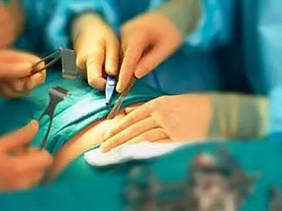 انجام بیش از ۵۶۰ هزار عمل جراحی رایگان در سال گذشته