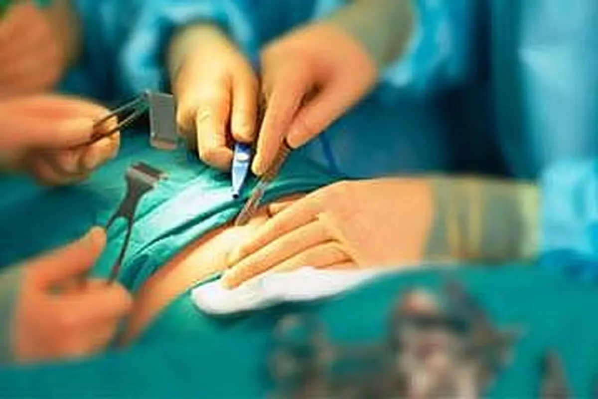 انجام بیش از ۵۶۰ هزار عمل جراحی رایگان در سال گذشته