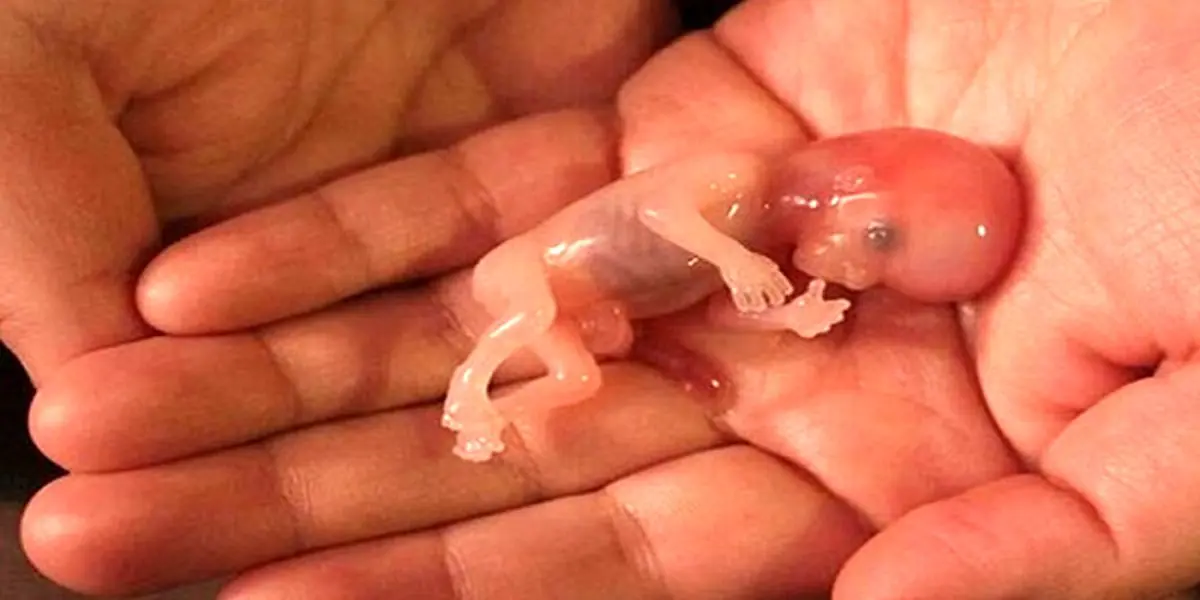 با این کارها از سقط خودبه خودی جنین جلوگیری کنید