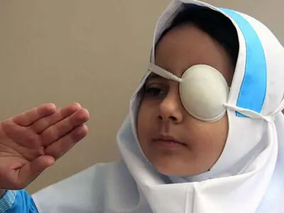 دلایل مهم تنبلی چشم در کودکان