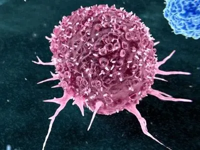 این عادت‌های روزمره بیشترین نقش را در ایجاد سرطان‌ دارند 