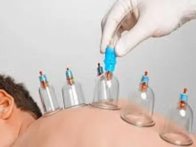 تقویم حجامت سال 1403