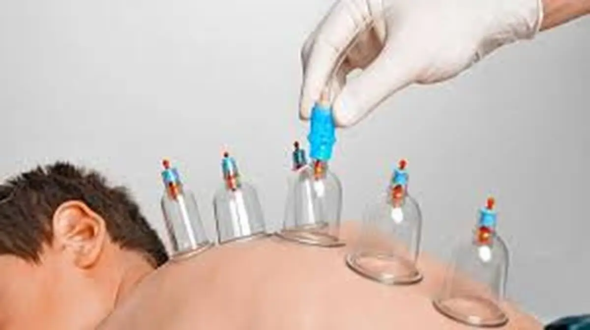 تقویم حجامت سال 1403