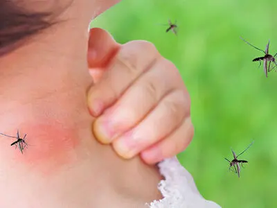 کودکتان را حشره گزیده؟ این علائم را جدی بگیرید