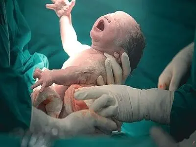 دانشگاه علوم پزشکی شهید صدوقی یزد در مورد فوت یک مادر باردار توضیحاتی ارائه داد