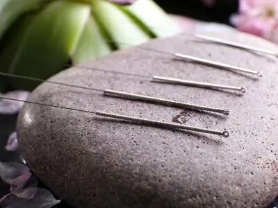 روش جوان سازی پوست با طب سوزنی