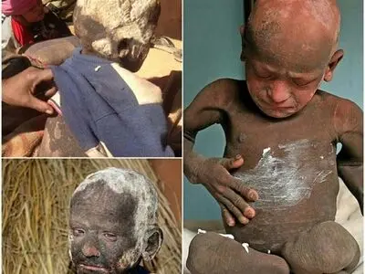 پسری که در حال سنگ شدن است/ عکس
