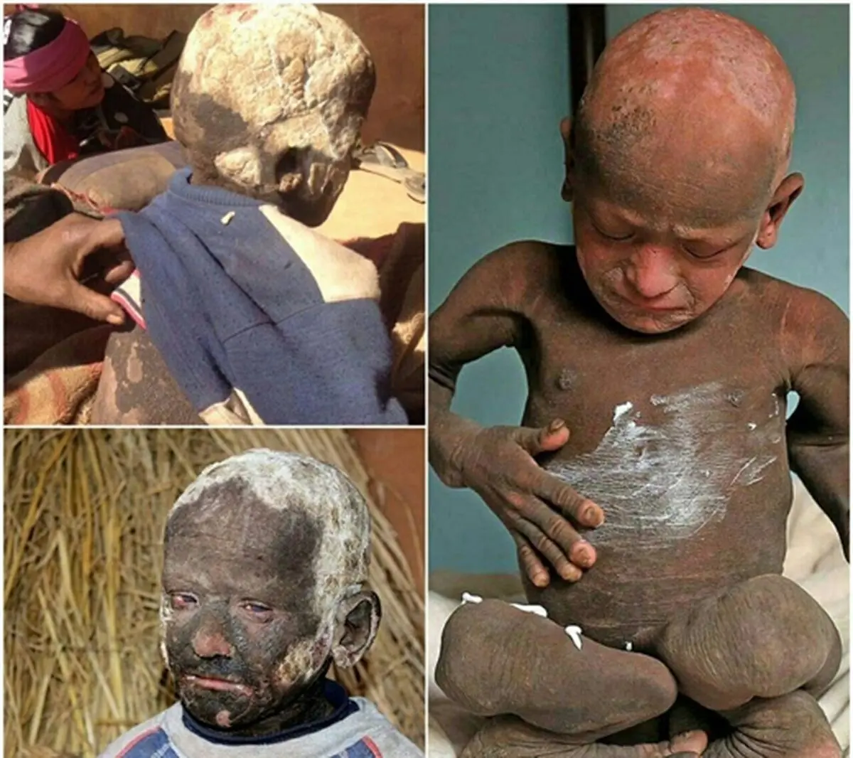 پسری که در حال سنگ شدن است/ عکس