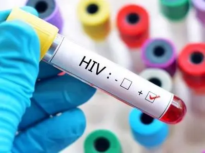 شاخص شناسایی و وصل به درمان در برنامه کنترل عفونت HIV در استان بالاتر از میانگین کشوری است