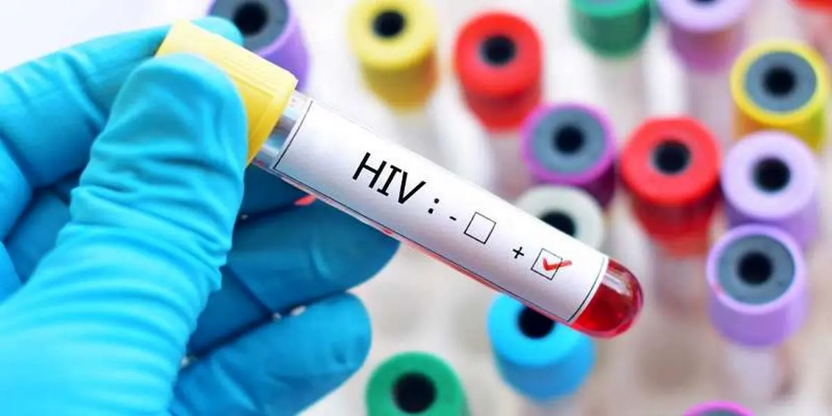 شاخص شناسایی و وصل به درمان در برنامه کنترل عفونت HIV در استان بالاتر از میانگین کشوری است