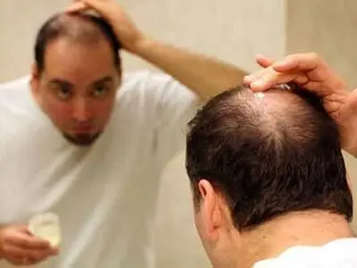 آداب مراقبت از موها در فصول سرد