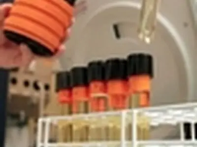 ۲ سال محرومیت در انتظار آزادکار دوپینگی