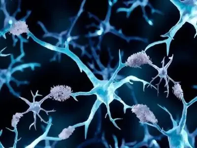 چرا آلزایمر کمتر سراغ مبتلایان به سرطان می‌رود؟