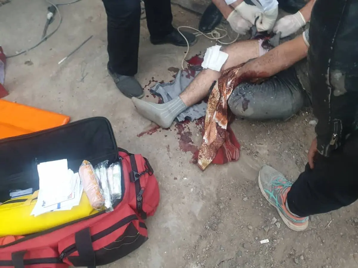 مصدومیت یک کارگر بر اثر انفجار بشکه 