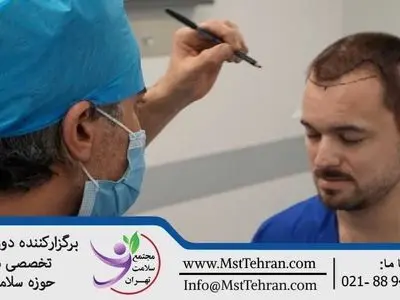 آموزش کاشت مو اقساطی در مجتمع سلامت تهران