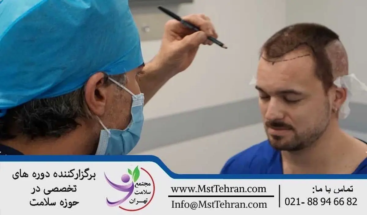 آموزش کاشت مو اقساطی در مجتمع سلامت تهران
