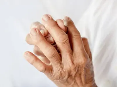 کدوم نوع تغییر شکل انگشتان دست، خطرناک است؟ 