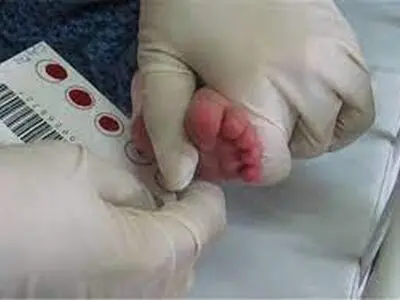 «غربالگری نوزادان» در مراکز دولتی دانشگاهی رایگان است