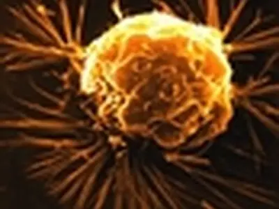 سمینار استراتژی‌های جدید تشخیص و درمان سرطان دهانه رحم برگزار می‌شود