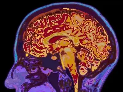 فلسفه ذهن چیست و چه کاربردی دارد؟ 