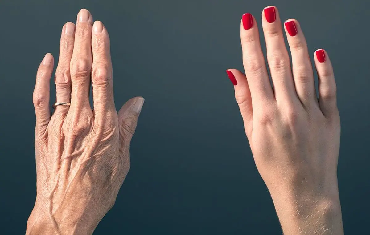 ۹ دلیل پوسته پوسته شدن ناخن و راه حل رفع آن 