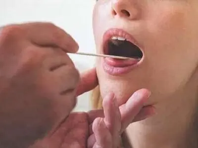 سوزش زبان نشانه این بیماری خطرناک است