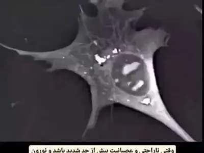 فروپاشی روانی این شکلی است + فیلم