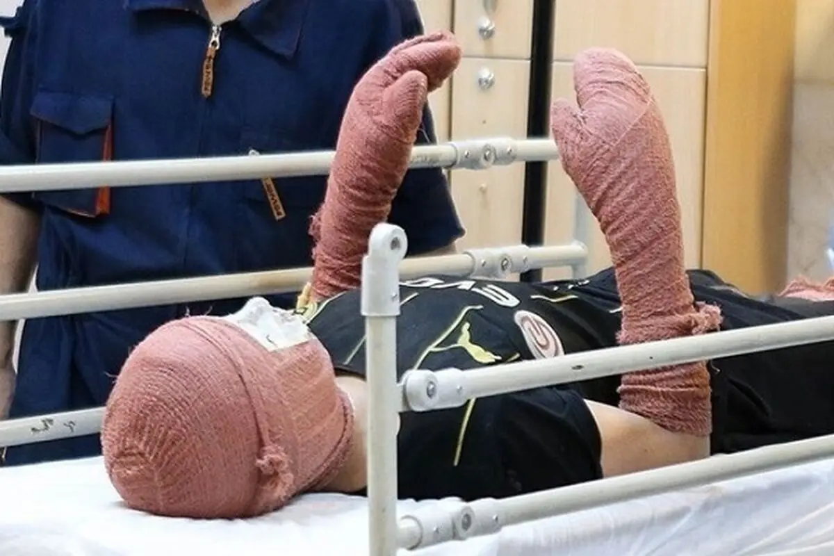 ۶ مصدوم و ۲ قطع عضو در حوادث چهارشنبه‌سوری