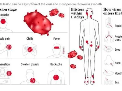 آنچه باید درباره ویروس Mpox بدانید