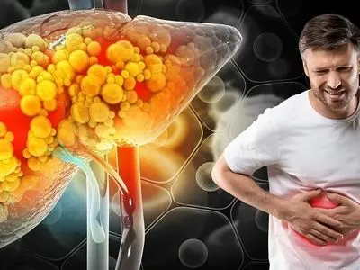 تنها راه درمان کبد چرب مشخص شد؛ معجزه می‌کند!