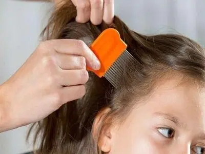 راهکار خلاصی کودک از شپش را بشناسید