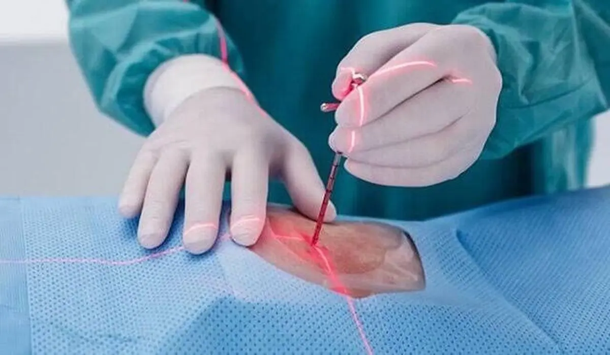 دیسک کمر همیشه به جراحی نیاز ندارد