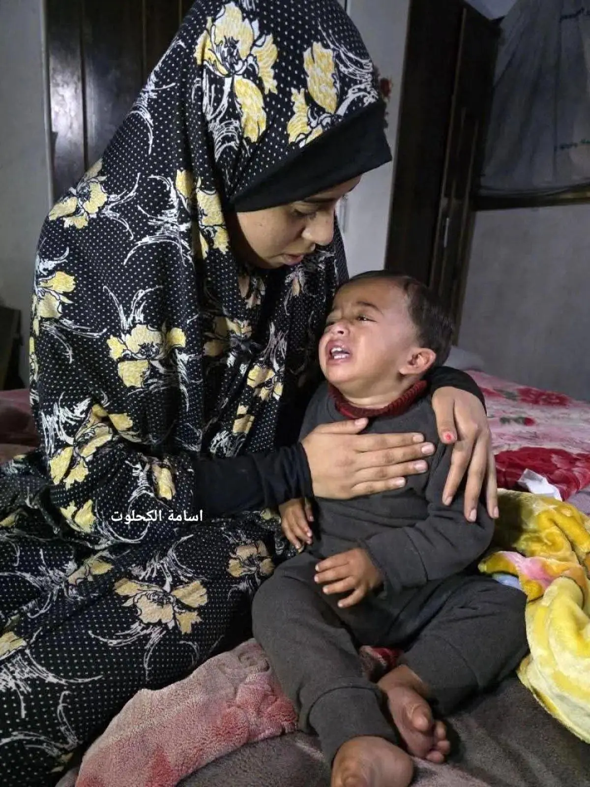 اسرائیلی ها پای کودک را سوزانده و میخ در پایش فرو کردند