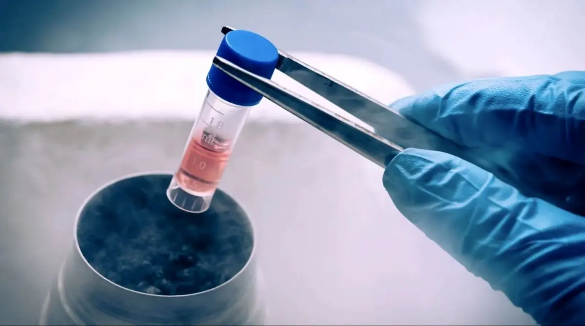 فریز تخمک؛ راهی برای حفظ باروری زنان